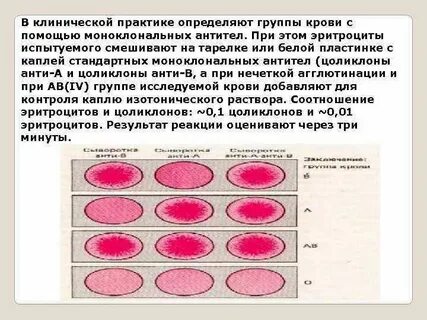 Агглютинация произошла с цоликлоном анти а