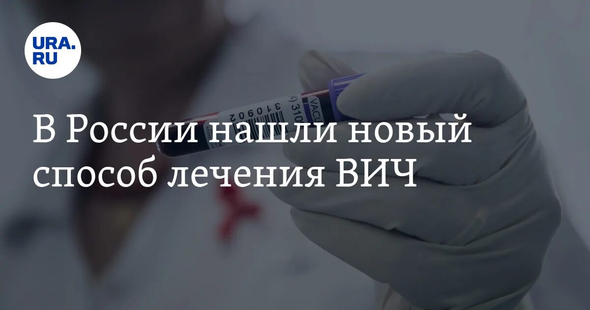 Когда нашли вич. ВИЧ новый прорыв в лечении. Лекарство от ВИЧ последние новости на сегодня в мире. Панайотов болен СПИДОМ.