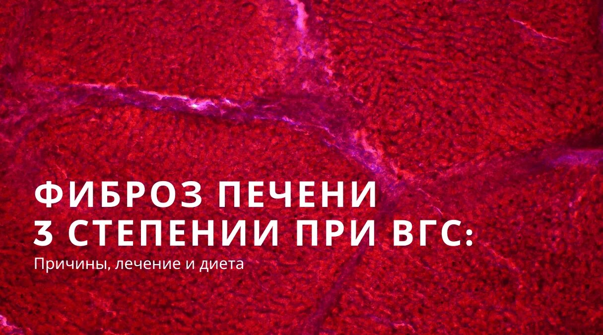 Препараты для лечения фиброза печени 3 степени. Лечение фиброза печени 3