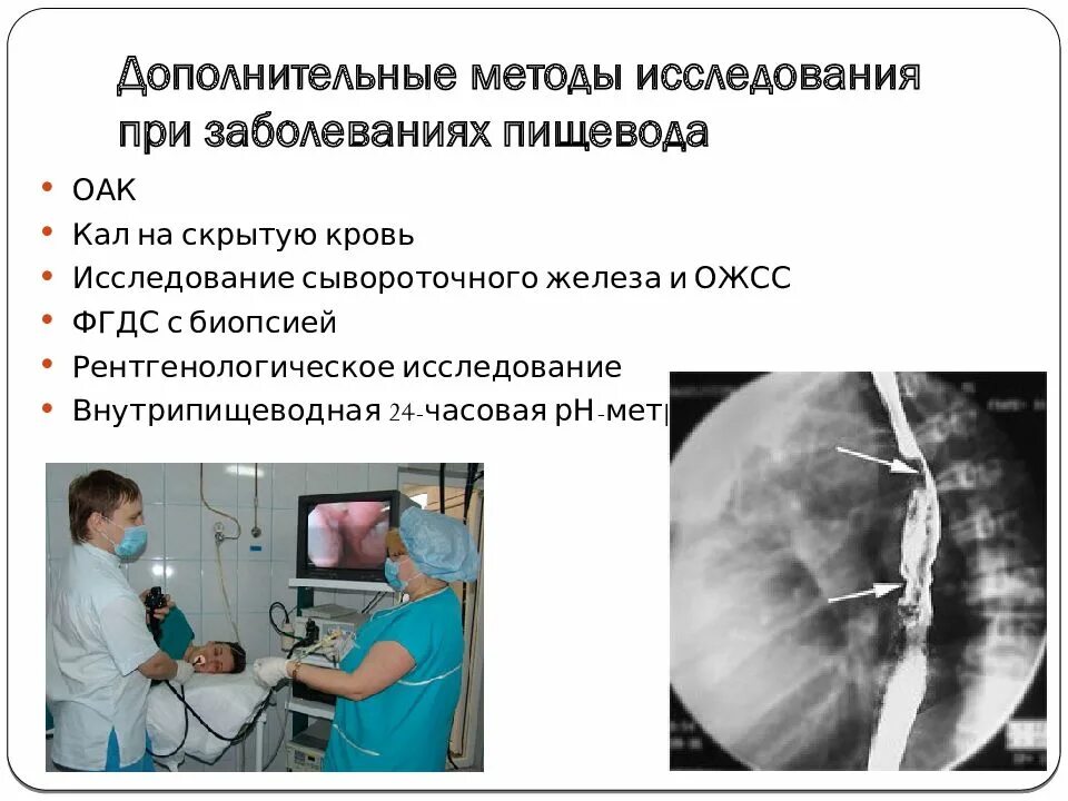Дополнительные методы исследования больного. Методы диагностики заболеваний пищевода. методы обследования при заболеваниях пищевода. исследования при заболеваниях пищевода. дополнительные методы исследования пищевода.