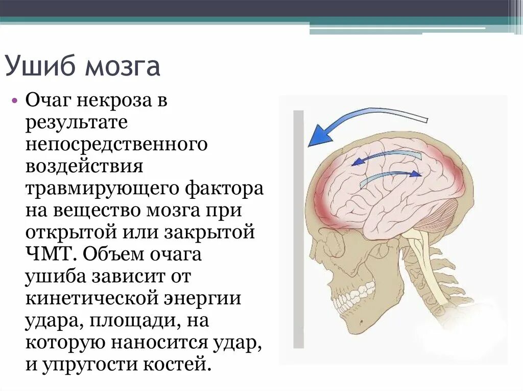 Повреждения головного мозга возникают