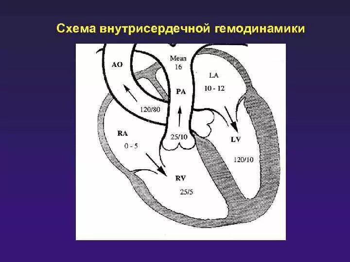 Нарушение внутрисердечной гемодинамики. Транспозиция магистральных сосудов гемодинамика схема. Гемодинамика схема. Гемодинамика сердца схема. Внутрисердечная гемодинамика.