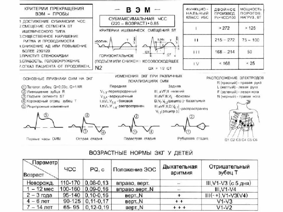 Чсс по экг 25. Экг прекращения велоэргометрической пробы. формула расчета субмаксимальной чсс. критерии прекращения велоэргометрической пробы. субмаксимальная чсс у детей.