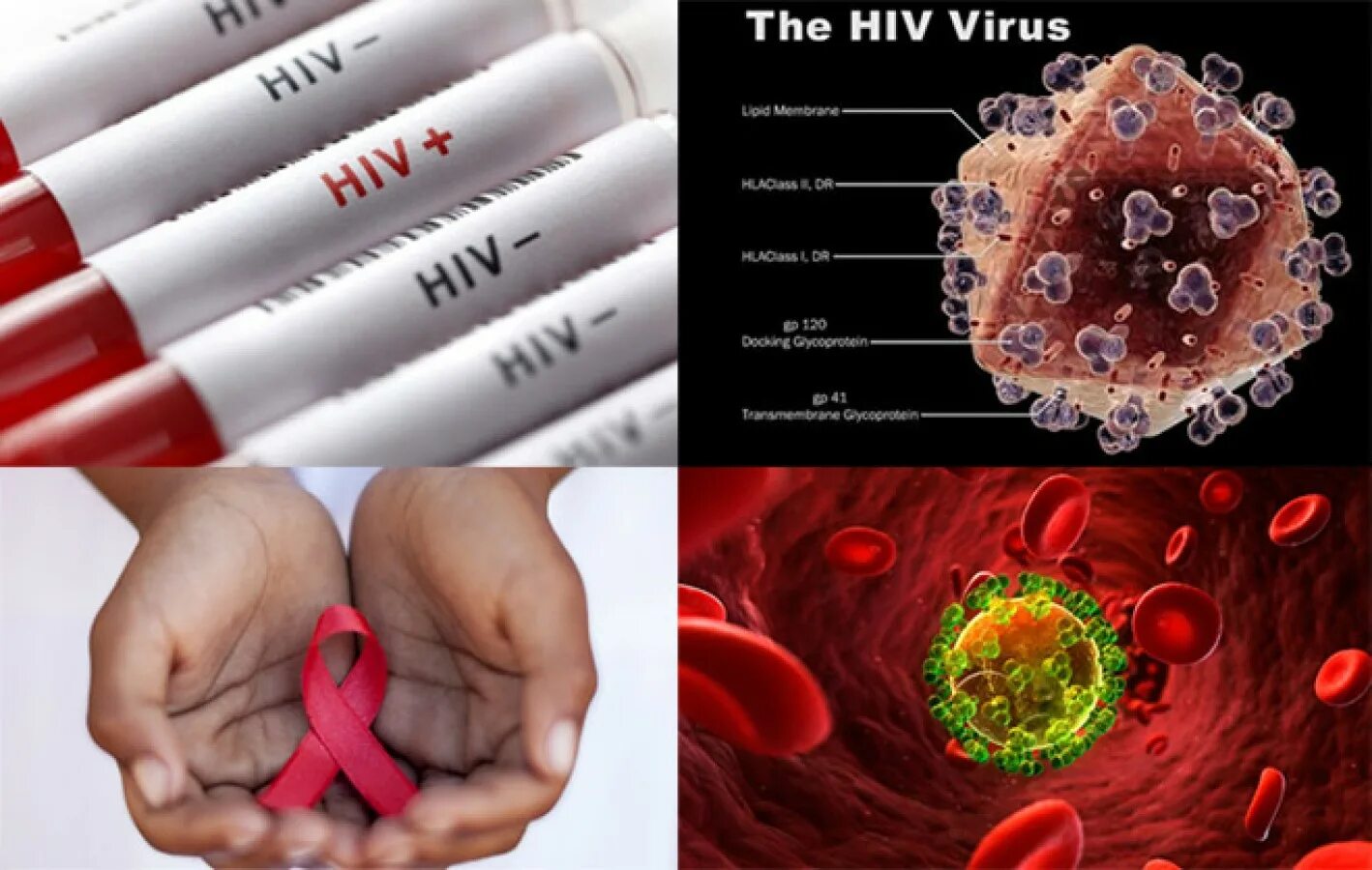 ВИЧ инфекция. СПИД. Фото ВИЧ инфицированных. Цвет вич