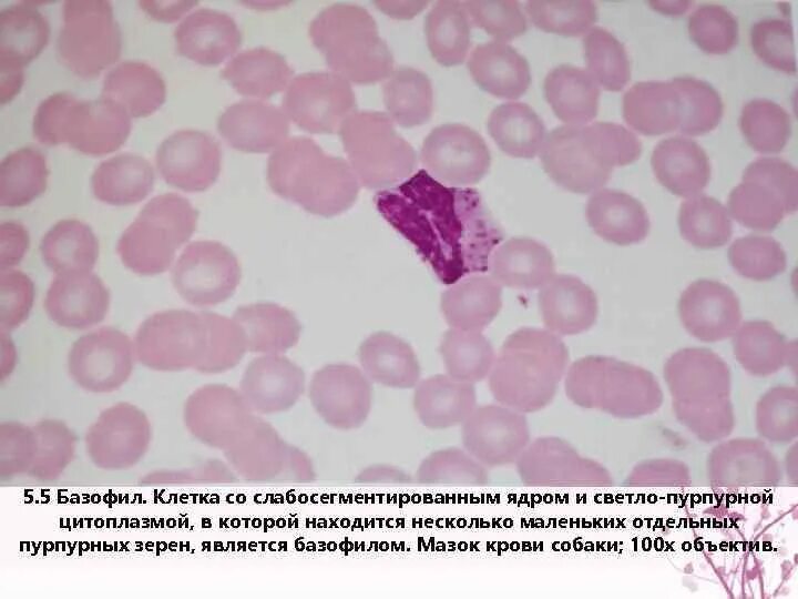 Базофилы мазок крови. Базофилы в мазке крови. Базофилы место разрушения. Многочисленные мелкие тельца