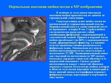 Внутренний слой матки