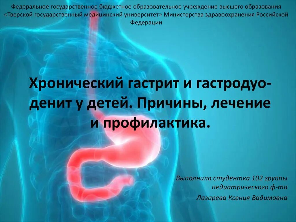 Гастродуоденит причины. Хронический гастродуоденит презентация. Гастродуодениты у детей презентация. Хронический гастрит и гастродуоденит у детей презентация.