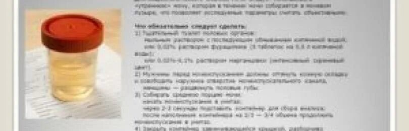 Правильный сбор суточной мочи для анализа. Что нельзя есть перед сдачей мочи. Перед сдачей анализа мочи что нельзя. Сбор мочи на общий анализ у новорожденного. Можно мочу ставить в холодильник