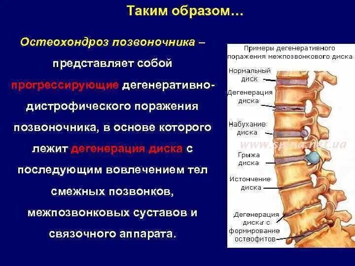 Дистрофические изменения позвоночника. Жировая дегенерация позвонков на мрт. Дегенеративно-дистрофические заболевания позвоночника (ддзп). Ддзп остеохондроз позвоночника. Дегенеративные изменения в теле позвонка.