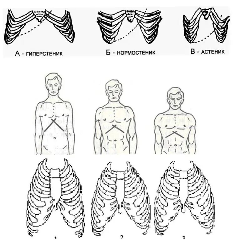 У спортсменов чаще наблюдается форма грудной клетки. Форма грудной клетки у астеников. нормостеническая форма грудной клетки. нормостенический тип грудной клетки. гиперстенический тип грудной клетки.