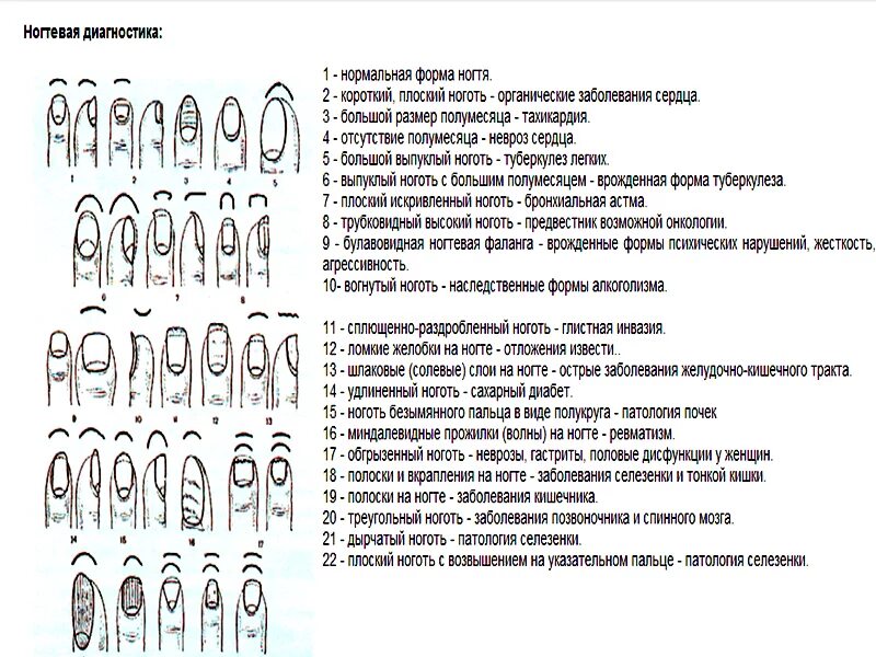 Что означают полосы на ногтях. Болезни по ногтям пальцев рук таблица. Диагностика заболеваний по ногтям на руках. Определение диагноза по ногтевой пластине. Диагноз болезни по ногтям.