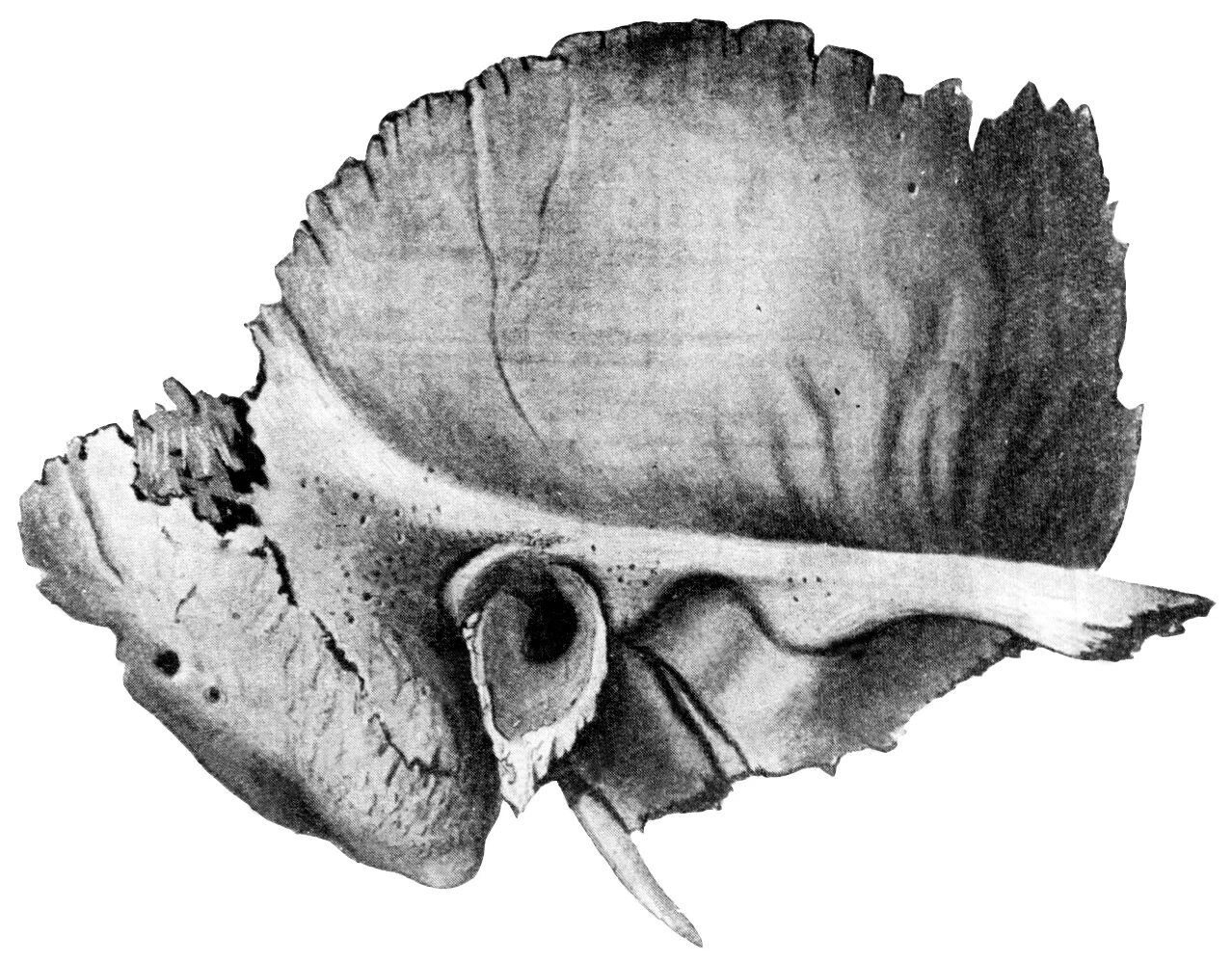 Височная кость анатомия. Височная кость анатомия Синельников. Височная кость вид снаружи и изнутри. Височная кость анатомия пирамида. Изменения височной кости