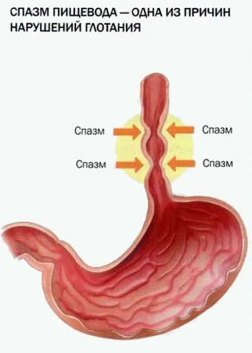 Как снять спазм желудка. Спастические сокращения пищевода. Пищевод человека.