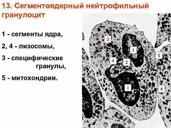 Сегмента ядерная. 1) Электронограмма ядра. Сегментоядерные нейтрофилы Электронограмма. Электронограмма гранулярной эндоплазматической сети. Электронограмма сегментоядерные гранулоциты.