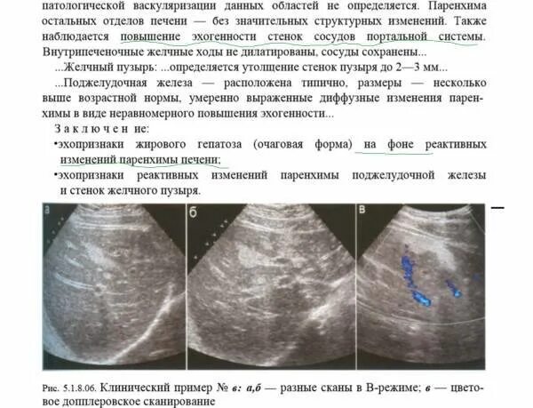 Паренхима печени диффузно изменена. Реактивные изменения поджелудочной железы на УЗИ. Реактивные изменения печени по УЗИ. Диффузные изменения печени паренхимы печени.