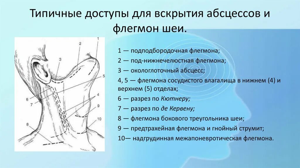 Флегмоны шеи Оперативная хирургия. Доступы для вскрытия флегмон шеи. Доступы для вскрытия абсцессов и флегмон. Разрезы при флегмонах шеи.