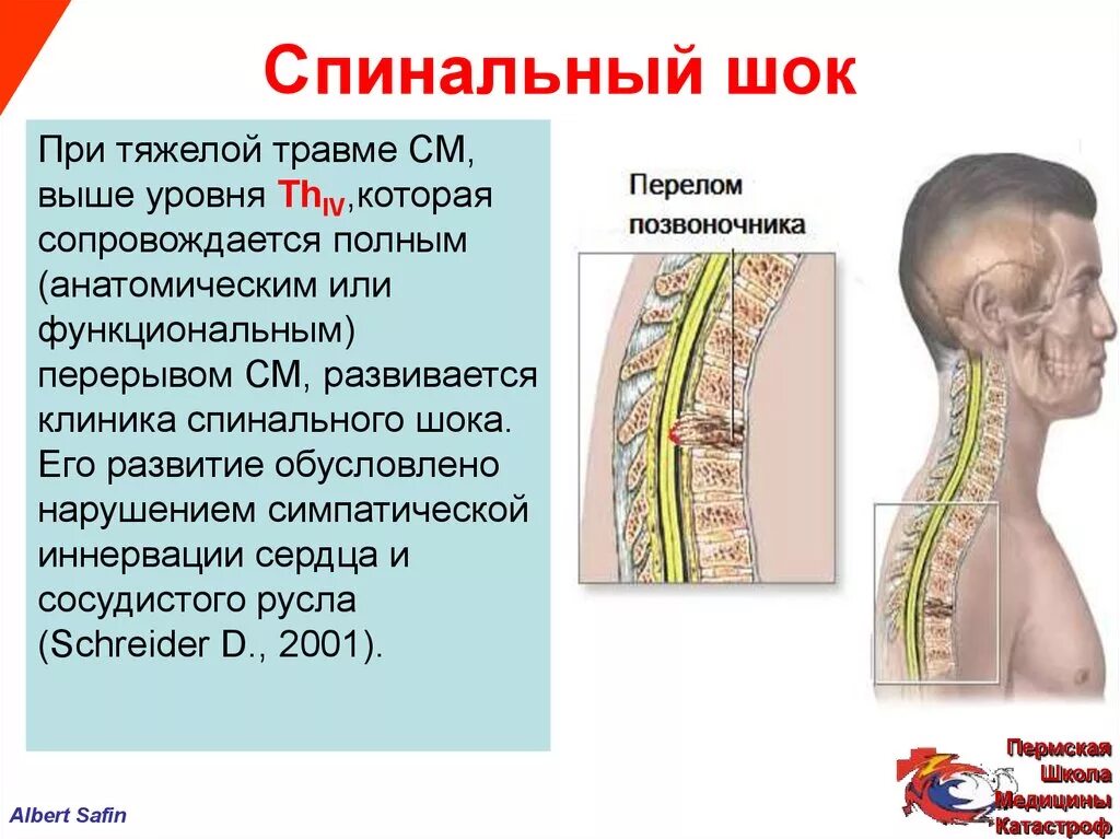 Сотрясение спинного. Механизмы и симптомы спинального шока.. Травмы позвоночника и спинного мозга. Спинальный ШОК этиология. Травматические повреждения спинного мозга.