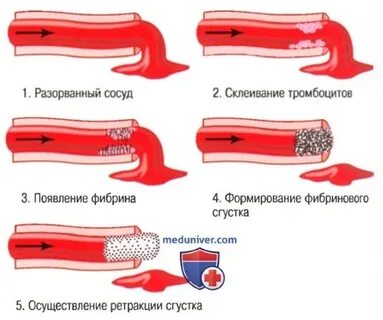 Разрыв сосуда причины