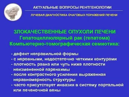 Злокачественные опухоли печени