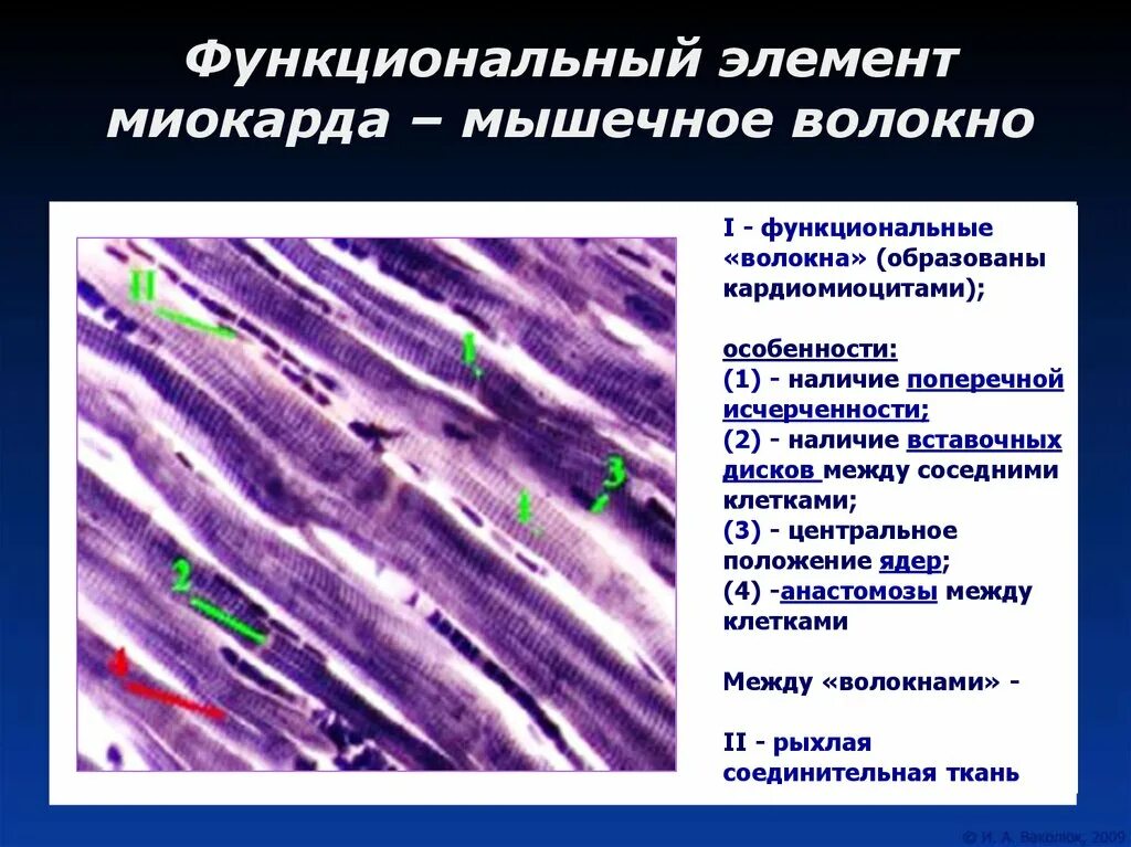 Состоит из клеток имеющих поперечную исчерченность. Строение кардиомиоцитов миокард. Мышечные волокна миокарда. Функциональные волокна кардиомиоцитов. Функциональное мышечное волокно.