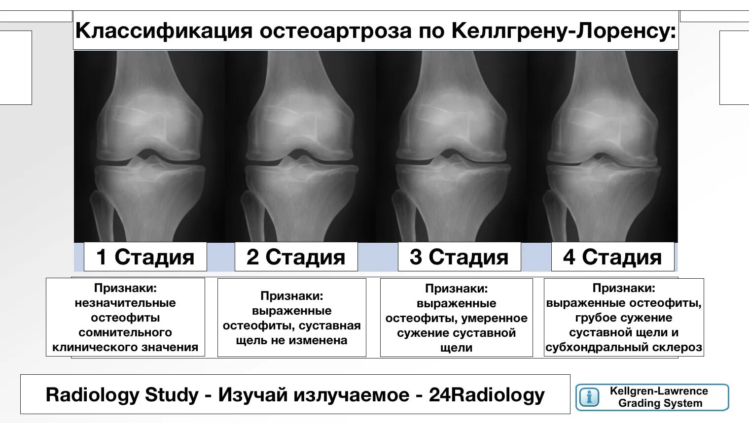 Коленный сустав по стадиям