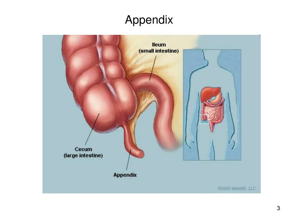 Аппендикс и аппендицит. Локализация аппендицита.
