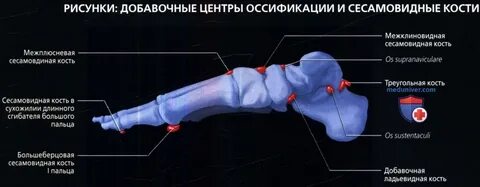 Ладьевидная кость стопы мкб