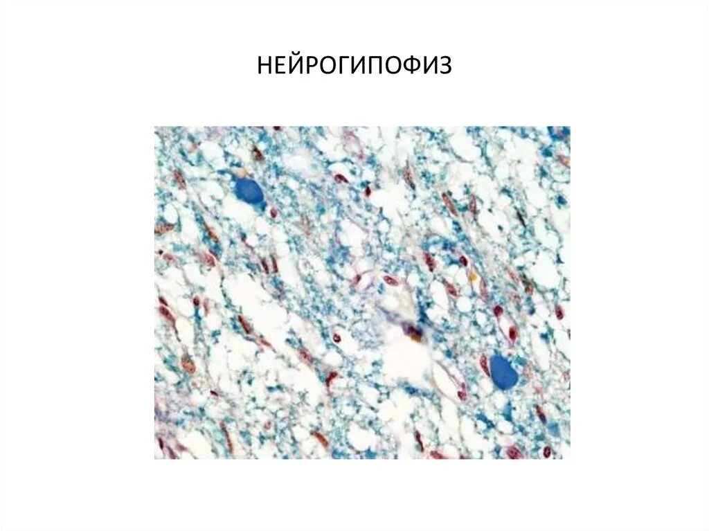 Нейрогипофиз гистология. Нейрогипофиз гистология