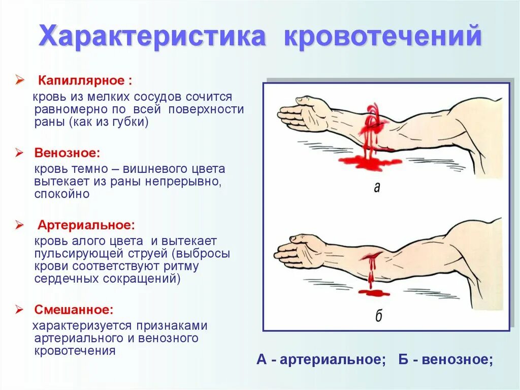 Какой сосуд поврежден. Особенности капиллярного кровотечения. Характеристика капиллярного кровотечения. Артериальное венозное и капиллярное кровотечение. Характеристика венозного и артериального кровотечения.