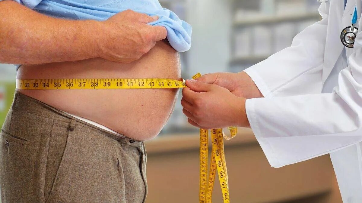 Толстый больной. Висцеральное ожирение. Люди с избыточным весом. Пациент с ожирением. Избыточный вес.