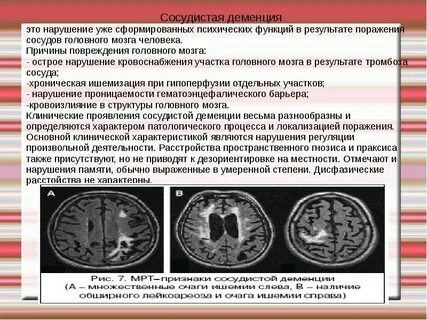 Что такое сосудистая энцефалопатия