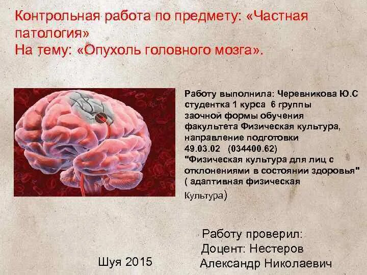 Отек мозга сколько. Стадии развития опухоли головного мозга. Локализация опухолей головного мозга.