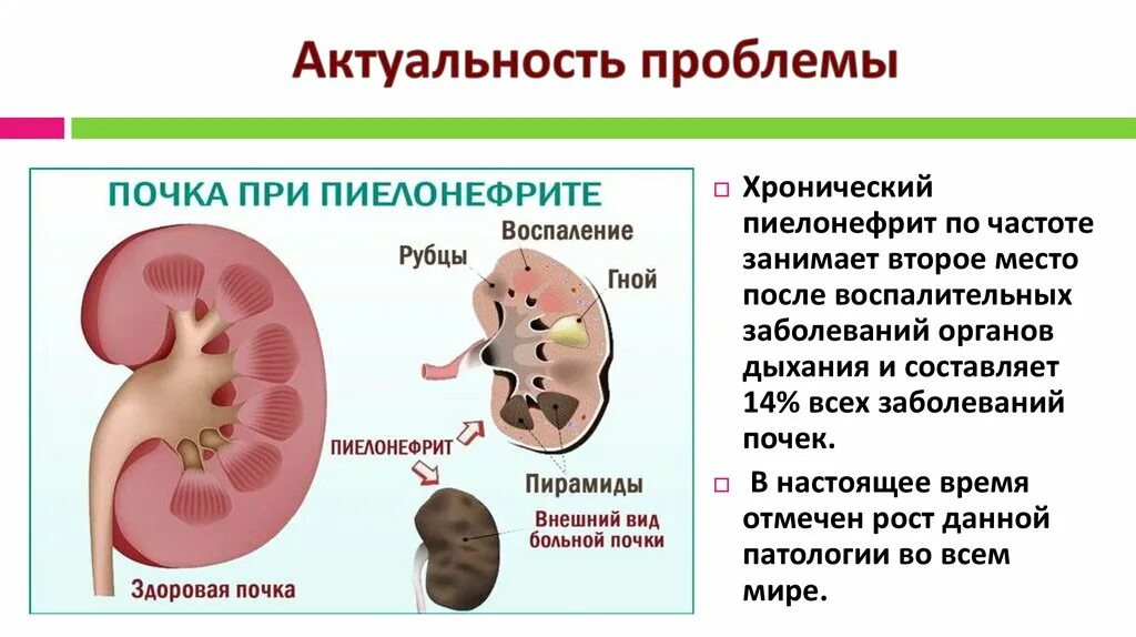 Почему плохие почки