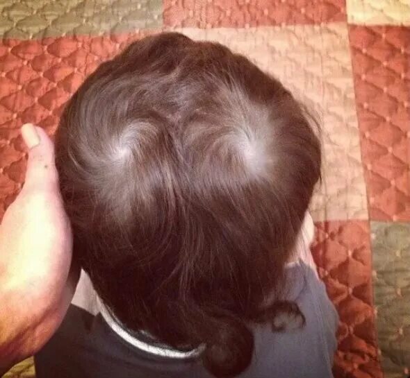 Две макушки. Две макушки на голове. 2 макушки. Драть вихры это. Драть вихры это.