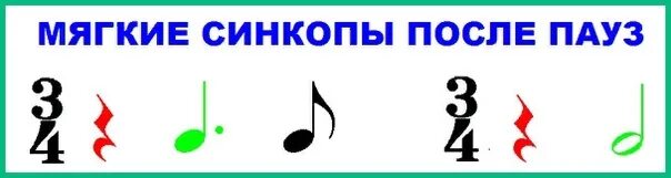 Смещение сильной доли на слабую. Виды синкоп в Музыке. Синкопа в Музыке. Ритм Синкопа. Синкопированный ритм в Музыке это.