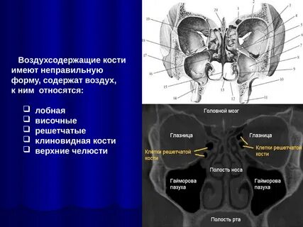Ячейки решетчатой кости