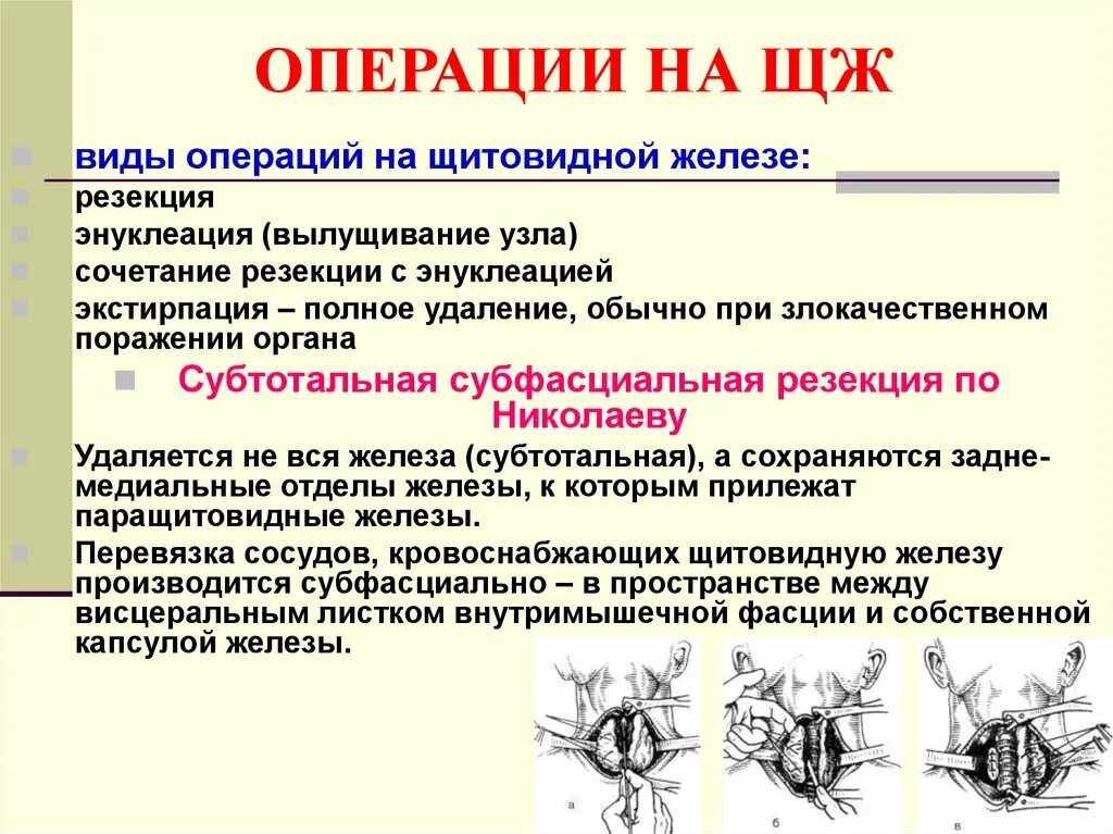 Сколько длится операция щитовидной. Операция на щитовидной железе. Операции на дит овидной железе. Операции на щитовидной железе виды. Операция на щитов железе.