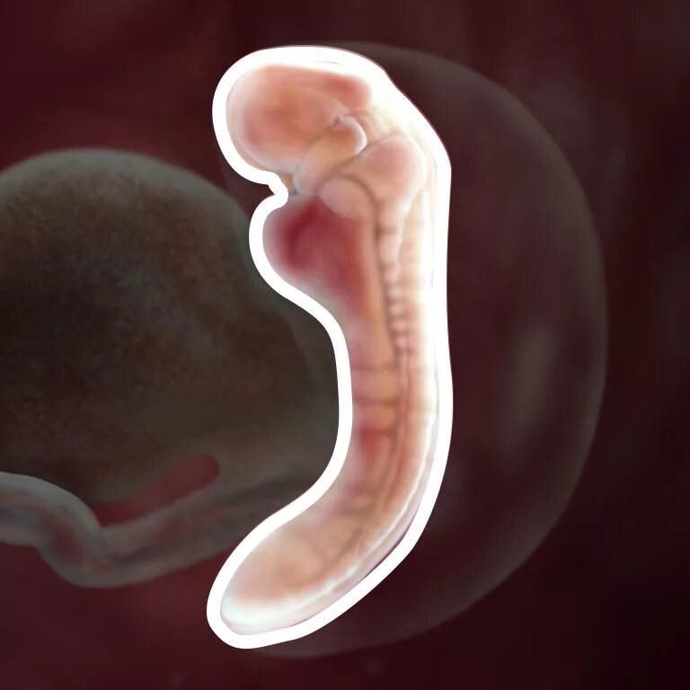 Беременность 5 недель фото. Зародыш человека 3-4 недели. Двухнедельный эмбрион. Двухл недельный эмбрион.