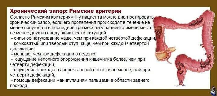 Кровотечение при дефекации. Геморроидальное кровотечение. Геморрой симптомы причины возникновения. Боль при дефекации у ребенка. Запор и боль при дефекации.