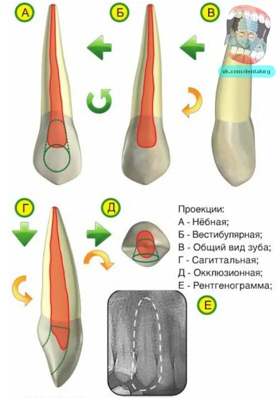 Зуб боковой резец. Верхний Центральный резец анатомия. Центральный медиальный резец верхней челюсти. Центральный резец верхней челюсти анатомия. Строение резцов верхней челюсти.