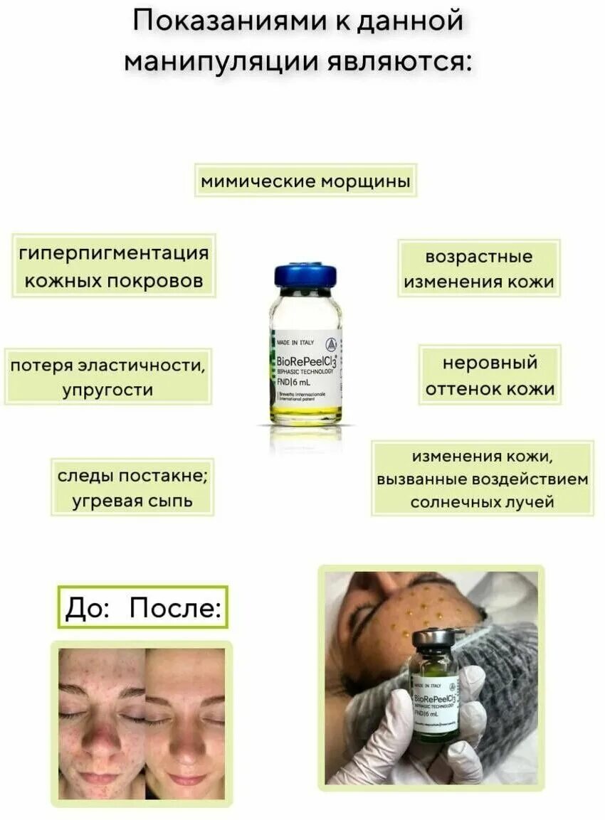Biorepeelcl3 отзывы до и после Пілінг "Біорепіл" (BioRePeel): склад, показання, фото до і після, відгук Estet