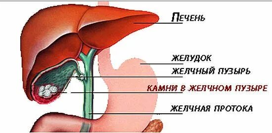 Тяжесть в желчном пузыре