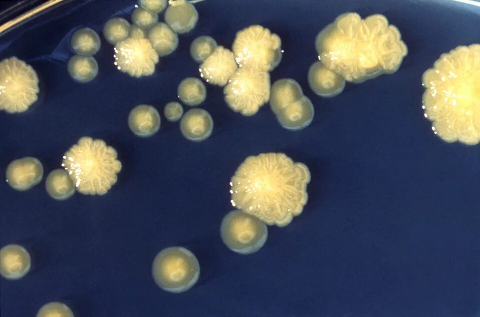 Enterobacter cloacae что это. Энтеробактер клоаке. энтерококк клоаке. cloacae бактерия. энтеробактер cloacae в кале.