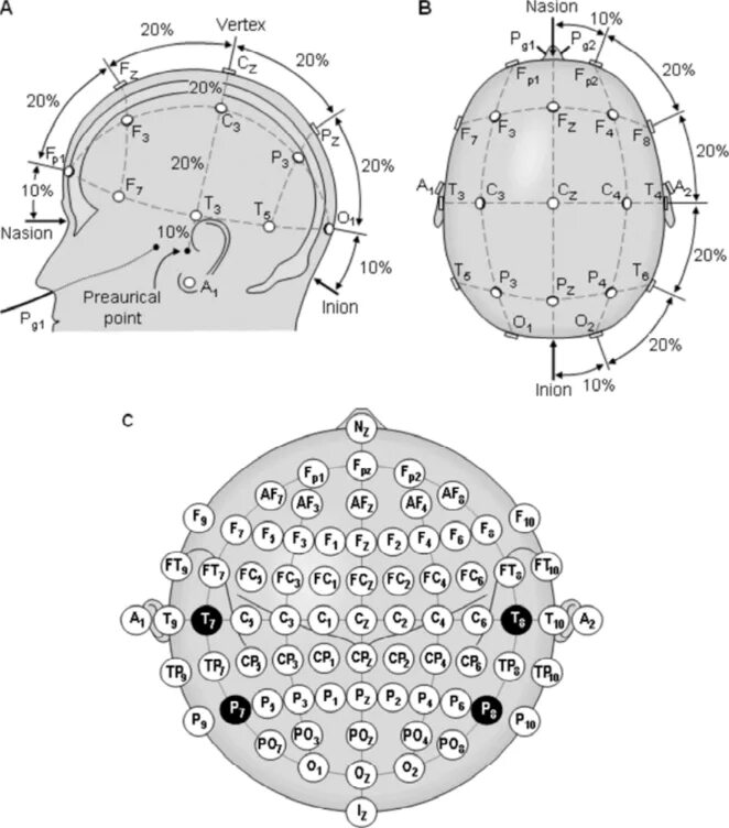 Ээг 7. ЭЭГ наложение электродов схема 10-20. Схема наложения электродов при ЭЭГ 10-20. Схема ЭЭГ 10 электродов. Схема наложения электродов ЭЭГ.