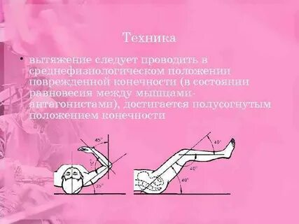 Придать конечности