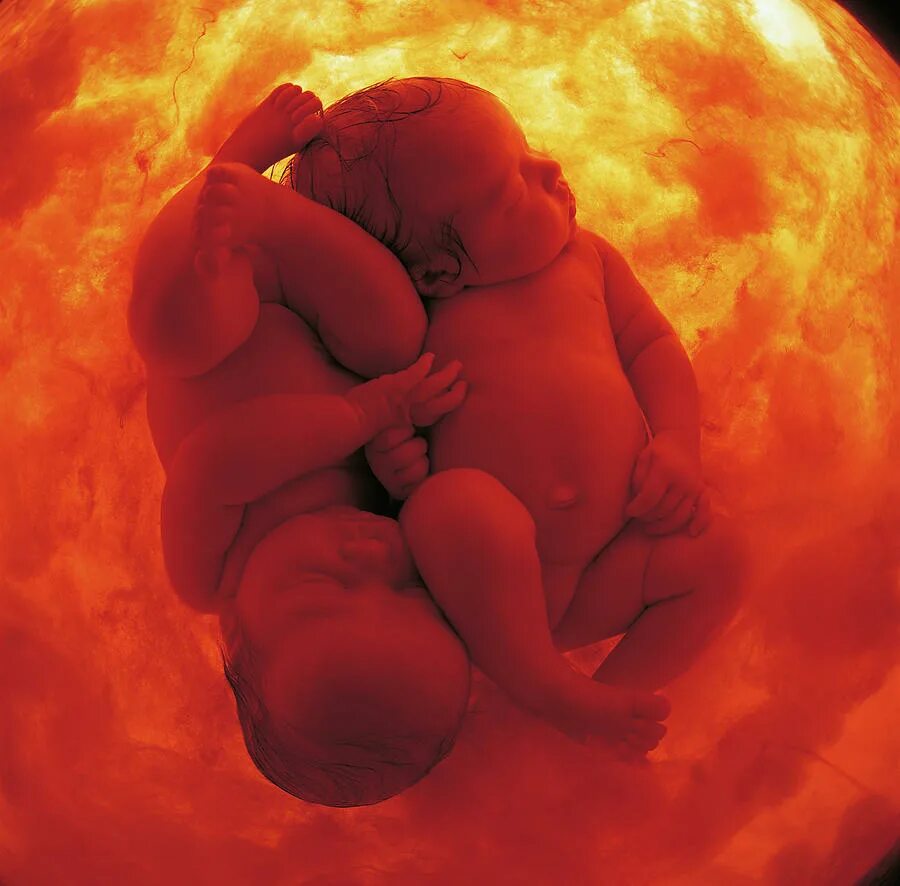 Эмбрион многоплодная беременность. УТ детям. Младенец в утробе матери. Притча про младенцев в утробе матери