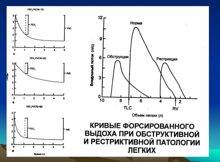 рестриктивный тип нарушения фвд. синдромы нарушения внешнего дыхания. функции внутреннего дыхания. спирометрия показатели спирометрии. обструктивный тип нарушения дыхания.