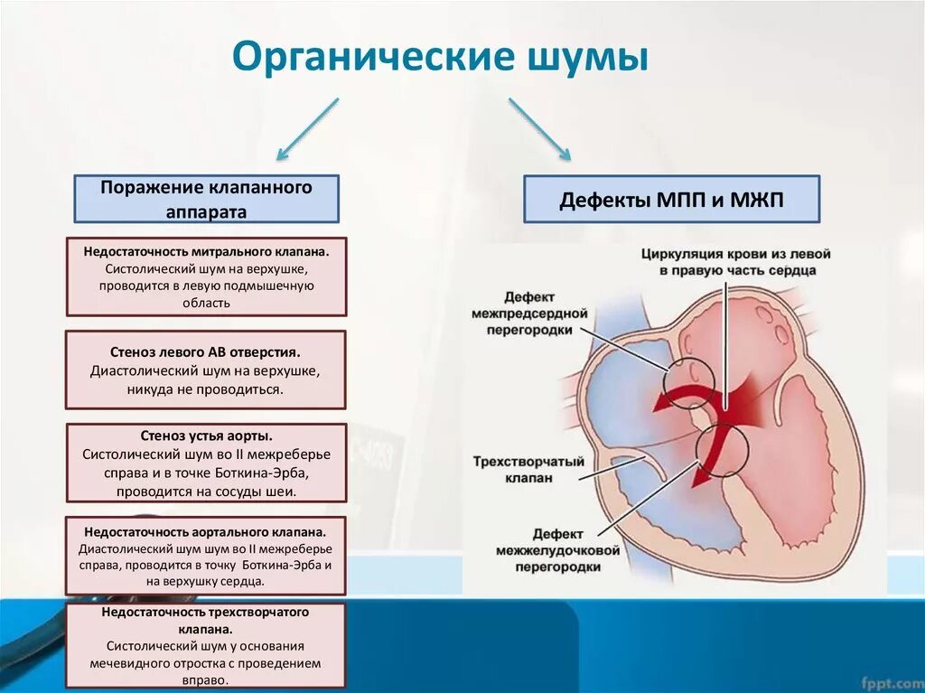 Поражение митрального клапана. Причины органического систолического шума. Шумы клапанов сердца. Органические клапанные сердечные шумы. Органический шум в сердце возникает при.