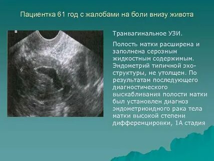 Почему матка левее