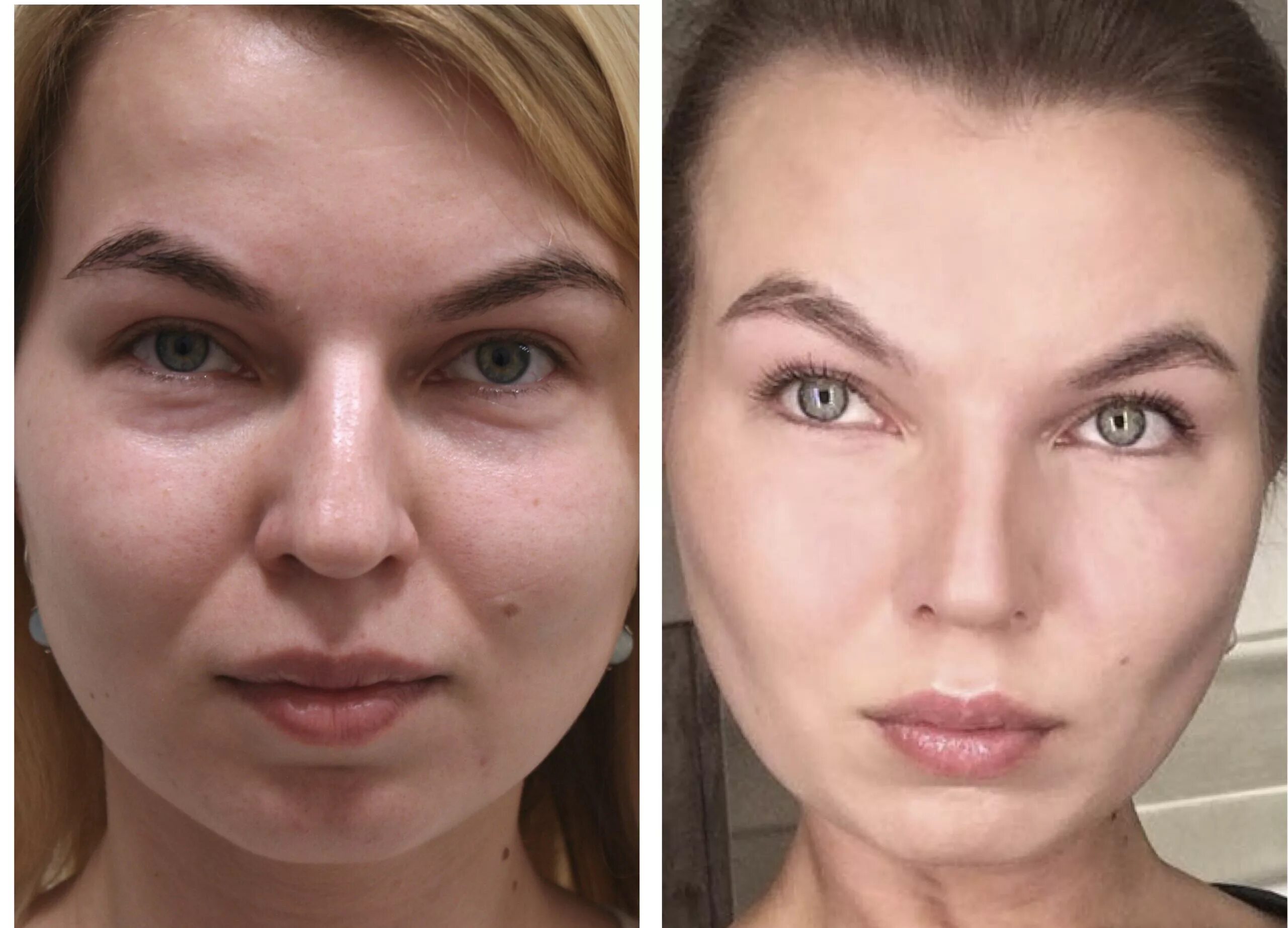 Что это такое по фото. Полина Гагарина комки Биша.